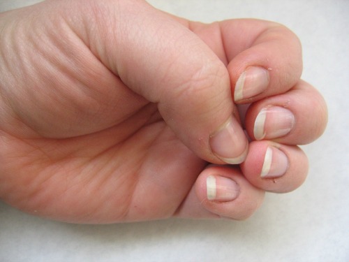 use coconut oil for cuticle problems.